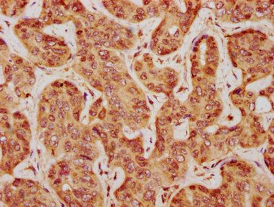 TGFB1 Antibody
