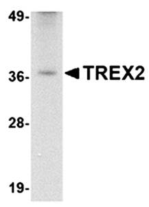 TREX2 Antibody