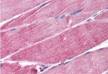 MURF1/TRIM63 (internal) Antibody
