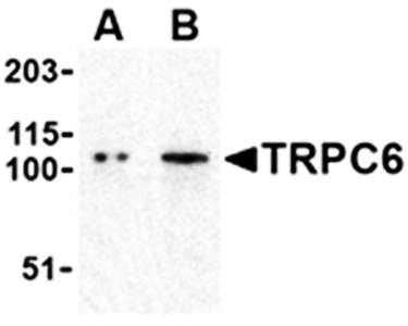 TRPC6 Antibody