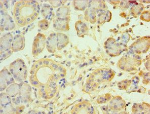 TRPM2 Antibody