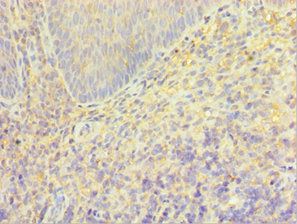 TRPM2 Antibody
