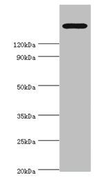 TRPM2 Antibody