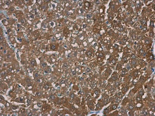 TRPM2 antibody [N1N2-2], N-term