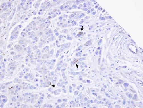 TRPM2 antibody [N1N2-2], N-term