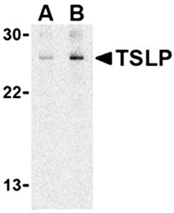 TSLP Antibody