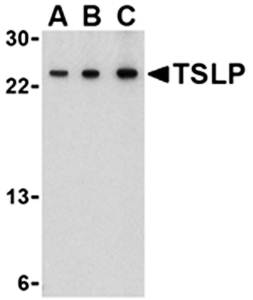 TSLP Antibody