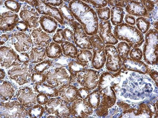 TST antibody
