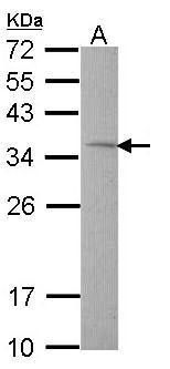 TST antibody
