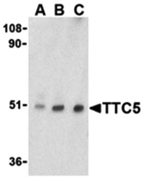 TTC5 Antibody