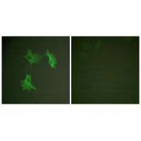 TUBA1A Antibody