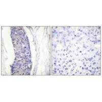 TUBA1A Antibody