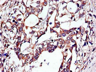 TUBA4A Antibody