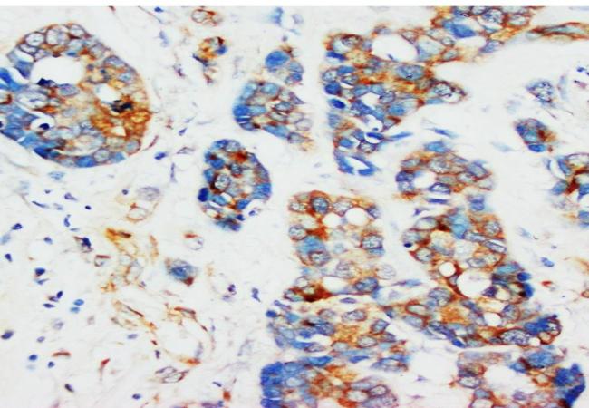 Anti-Alpha-Tubulin TUBA1A Antibody (Monoclonal, DM1A)