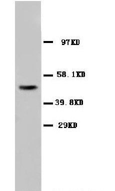Anti-Alpha-Tubulin TUBA1A Antibody (Monoclonal, DM1A)