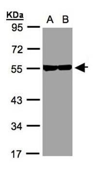 Tubulin beta-8 antibody