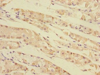 TXNDC5 Antibody