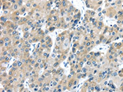 TXNDC5 Antibody