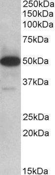 TXNDC5 (aa281-295) Antibody