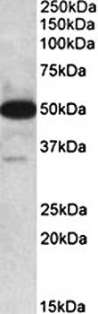 TXNDC5 (aa281-295) Antibody