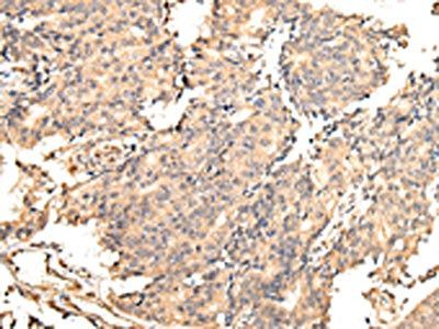 UGGT2 Antibody
