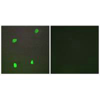 XRCC3 Antibody