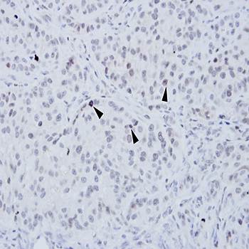 XRCC4 antibody