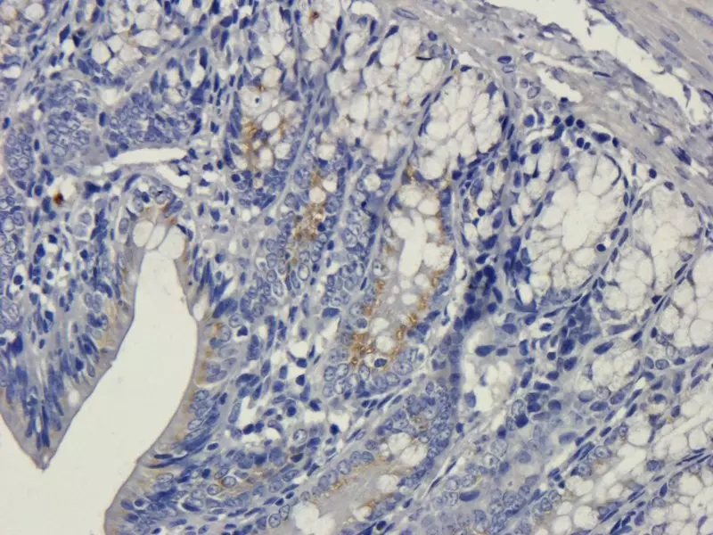 IHC-P Vegfa